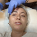 Microneedling experience at Serenity Bliss Holistic Center!