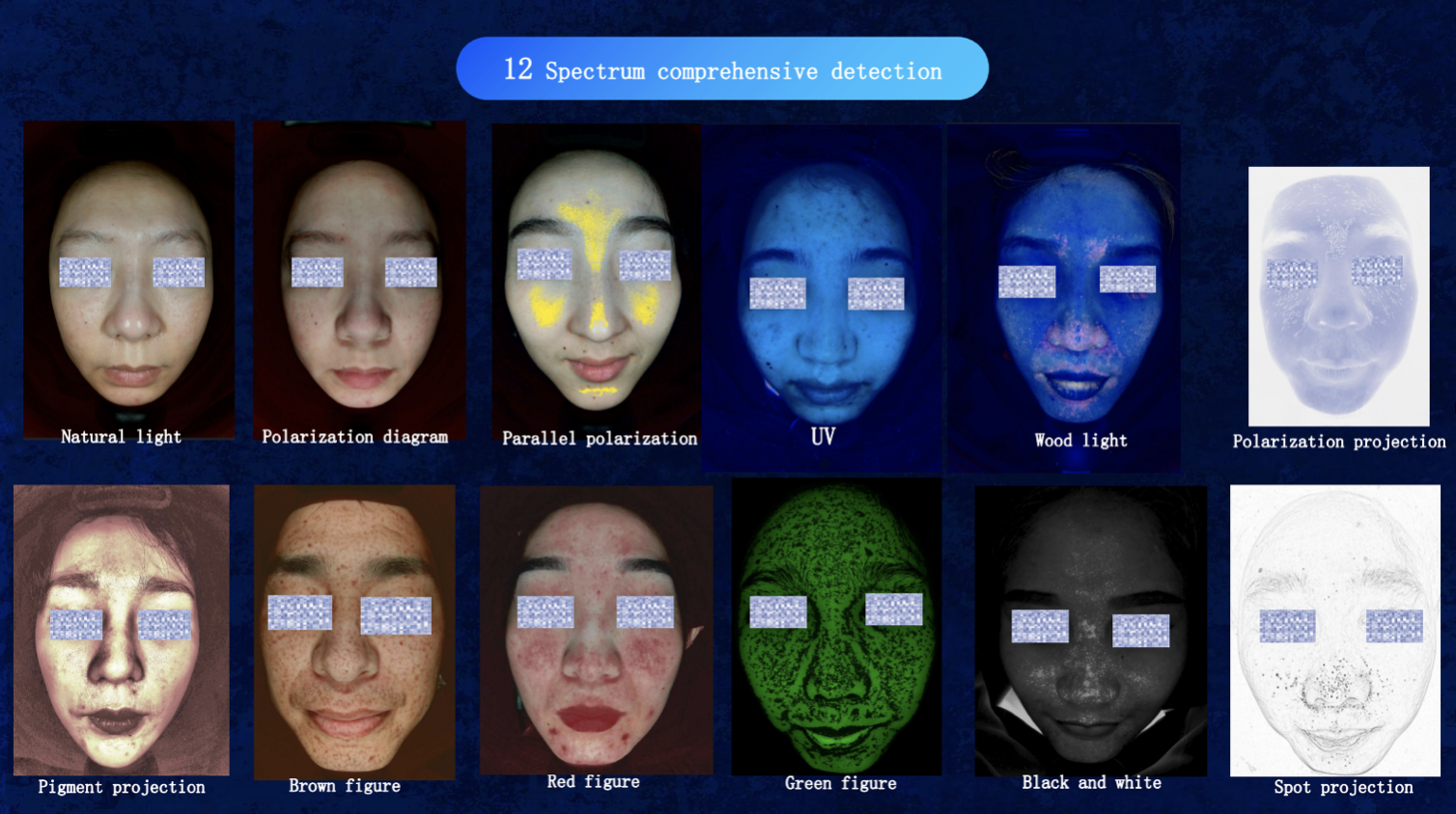 Skin Analyzer Consultation Serenity Bliss Holistic Center